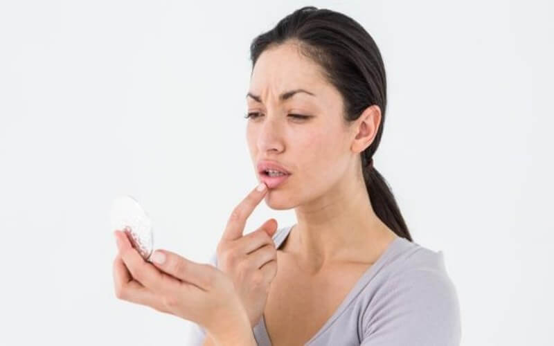 Bibir Kering Meski Terhidrasi Kenali Penyebab